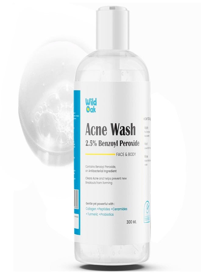 WILD OAK WildOak 2.5% Benzoyl Peroxide Acne Face Body Wash | 300ml | Kills 99.99% Acne Germs | Fights Severe Bacne | Unclogs Pores & Prevents Breakouts | Scientifically Proven Non-Drying Formula - Image 1