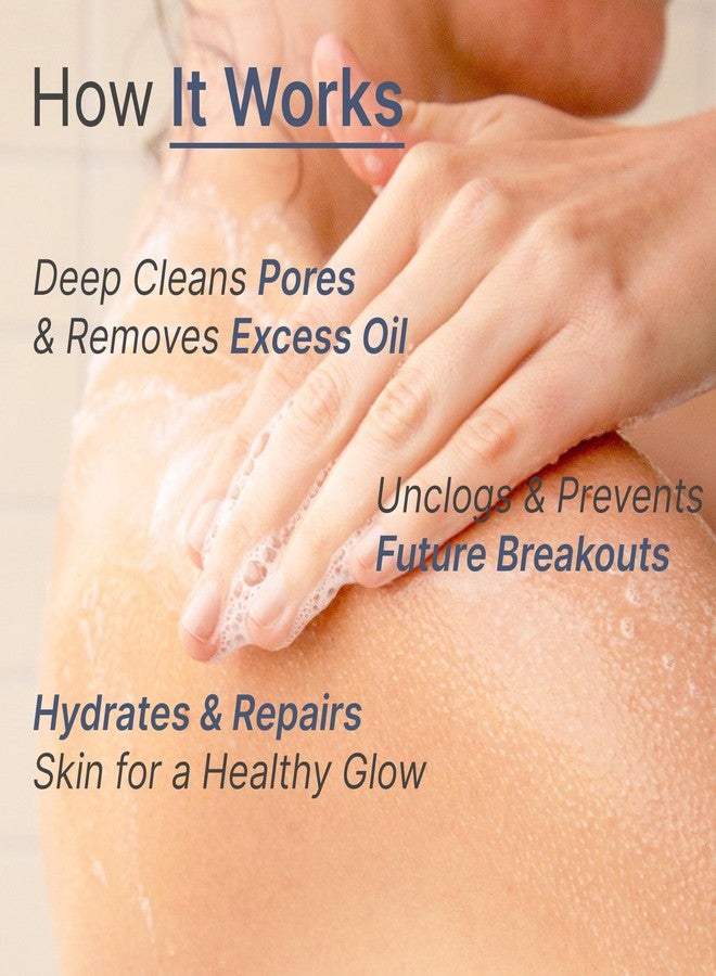 WILD OAK WildOak 2.5% Benzoyl Peroxide Acne Face Body Wash | 300ml | Kills 99.99% Acne Germs | Fights Severe Bacne | Unclogs Pores & Prevents Breakouts | Scientifically Proven Non-Drying Formula - Image 4