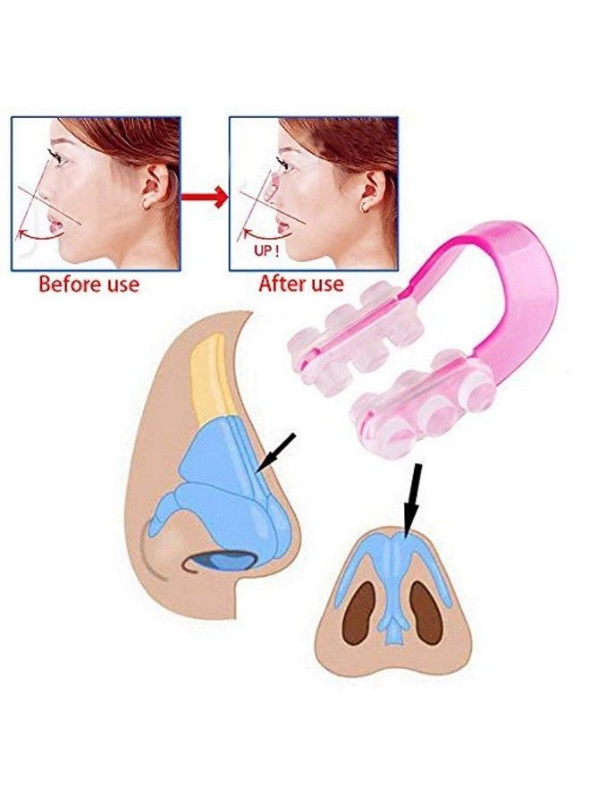 Alexvyan Combo Pink And Purple Nose Up Clip Shaping Lifting Bridge Straightening Purple Nose Up Beauty Clip High Lifting Clipper Correction Shaper For Shaping Beauty Tool - Image 4