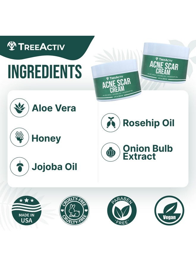 تري أكتيف علاج ندبات حب الشباب، كريم ندبات حب الشباب للوجه، ندبات حب الشباب اللطيفة ومزيل البقع الداكنة، غسول الندبات لعلامات التمدد وندبات الجسم، إزالة ندبات حب الشباب لجميع أنواع البشرة، أكثر من 500 استخدام - Image 5