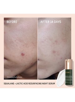BIOSSANCE BIOSSANCE Squalane + Lactic Acid Resurfacing Night Serum - Vegan 10% Lactic Acid Face Serum for Skin Texture and Fine Lines - Gentle Night Exfoliant, Hydrating - Pore Reducer for Face, 1.0 Ounce  - Image 2
