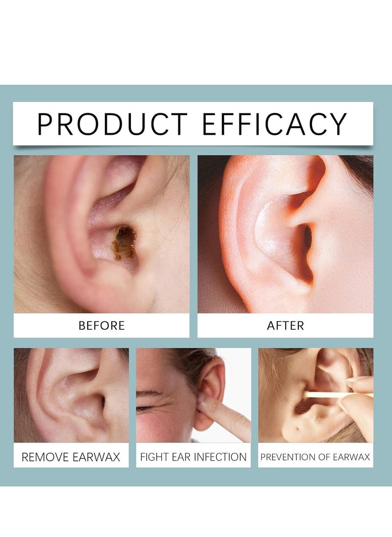 SOUTH MOON - Hearing Restoration Spray – Tinnitus Relief, Earwax Cleaning & Removal Drops, Gentle Microfoam Ear Wax Remover for Itchy Ears, Swimmer’s Ear, and Clogged Ears 50ml - Image 1