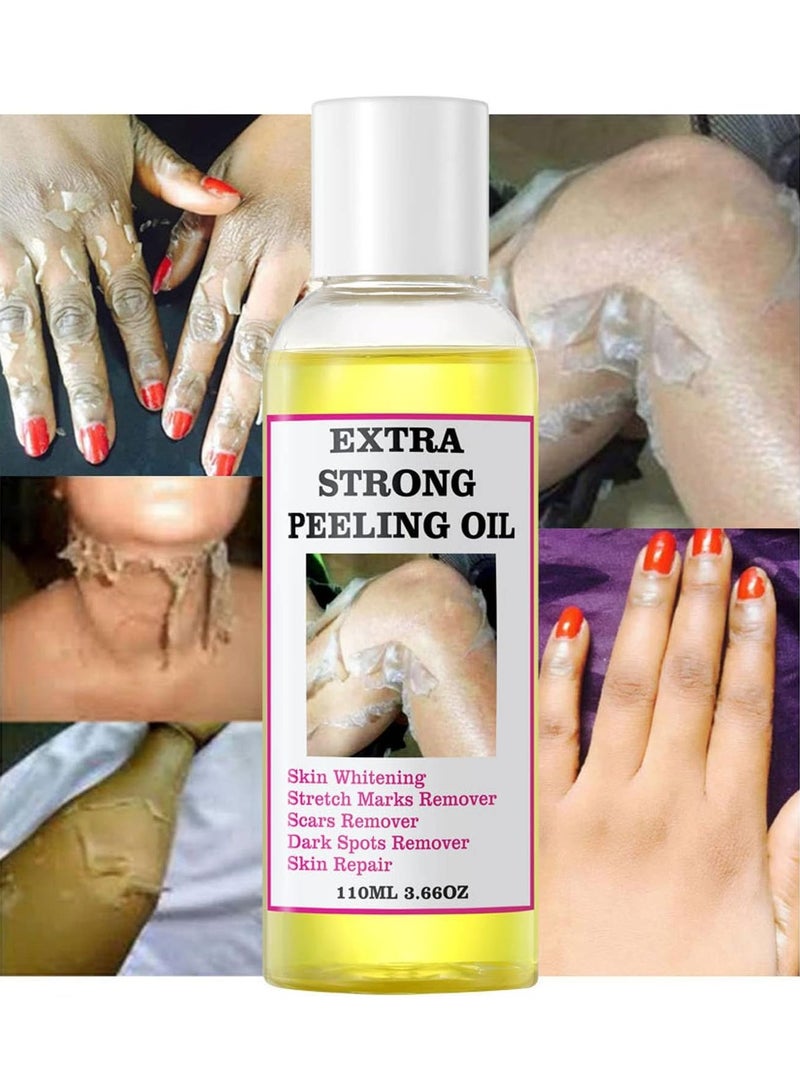 OUHOE زيت تقشير أصفر قوي إضافي، 110 مل زيت تقشير للبشرة الداكنة لتفتيح البقع الطبيعية زيت تقشير أصفر، حل تقشير لتفتيح الجسم، الكالو، المرفقين، الركبتين - Image 3