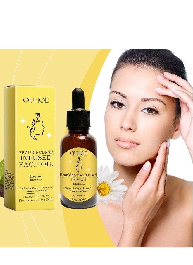 OUHOE - Frankincense Resin Oil For Face,30ML Frankincense Resin Infused Oil For Face,Organic Black Seed Castor & Jojoba Oils,Frankincense Resin Oil Essential,Cold Pressed Serum Anti-Aging Wrinkle - Image 1