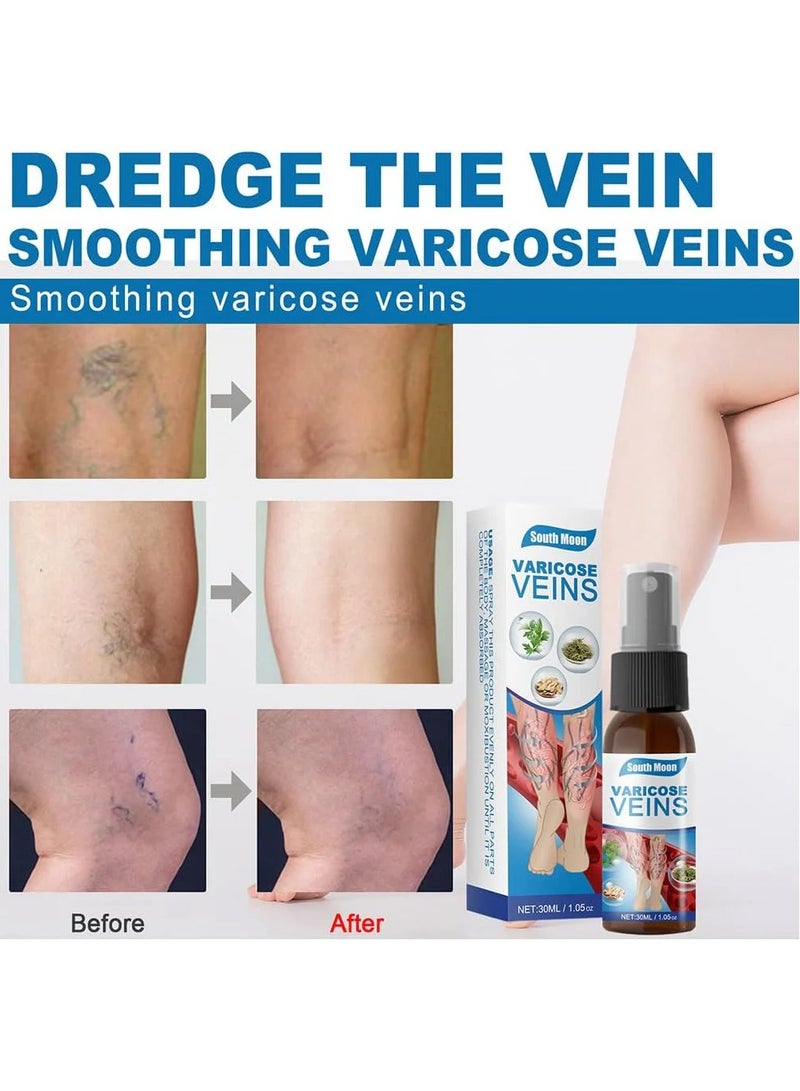 SOUTH MOON Effective Varicose Vein Remover Treatment Spray 30ml Relieve Leg Pain Spider Veins Vasculitis Vessels Bulging Unblock Veins Anti Varicose Veins Healing Cream - Image 3