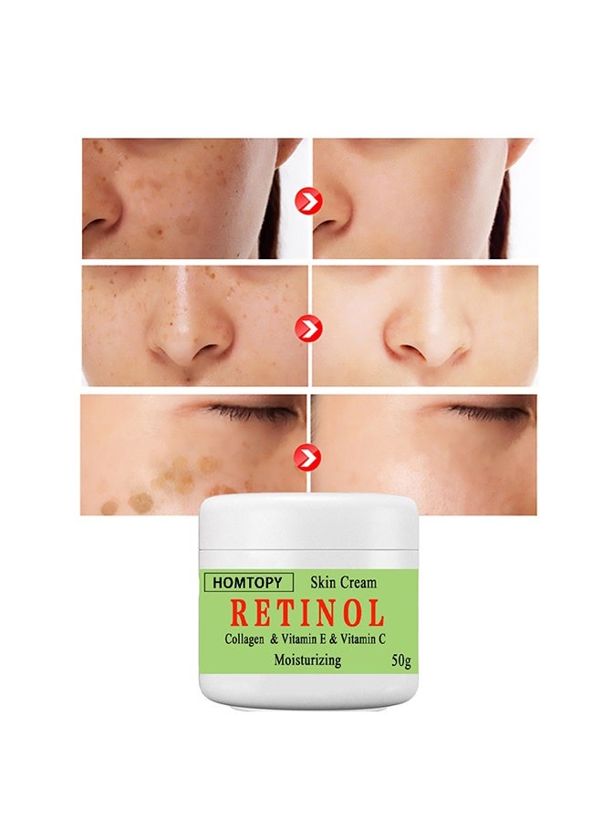 HOMTOPY Retinol &Collagen & Vitamin E &Vitamin C Moisturizing Skin Cream, Dark Spot Remover For Face For Face Snd Body Hyperpigmentation, Fades Melasma, Freckle, Sun Spots, Evens Skin Tone, Age Spot Remover 50g - Image 3