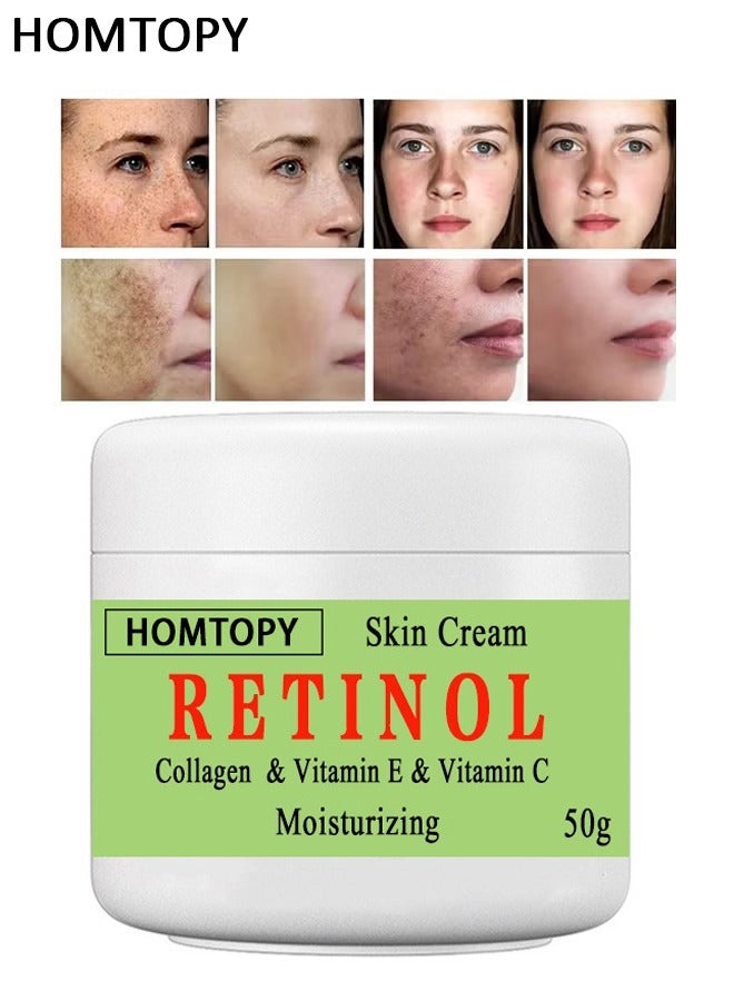 HOMTOPY Retinol &Collagen & Vitamin E &Vitamin C Moisturizing Skin Cream, Dark Spot Remover For Face For Face Snd Body Hyperpigmentation, Fades Melasma, Freckle, Sun Spots, Evens Skin Tone, Age Spot Remover 50g - Image 1