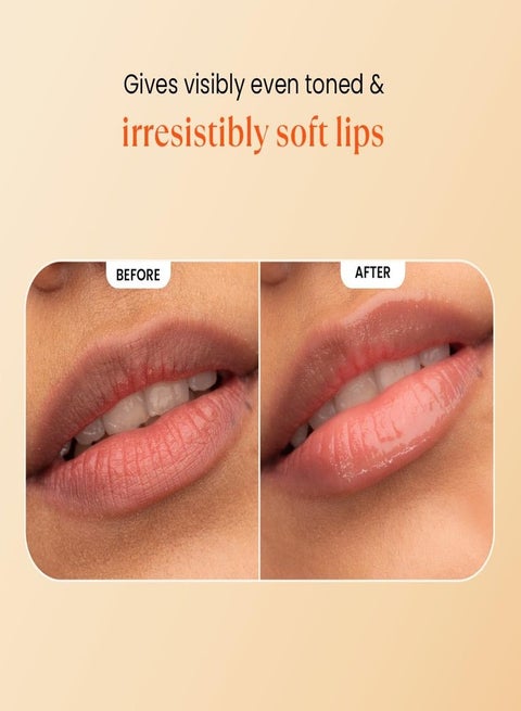 vitamin c on lips before and after & After] 2 months application of + gentle exfoliation has transformed my skin : r/SkincareAddiction NEUTRIHERBS Lip Cream, Vitamin C