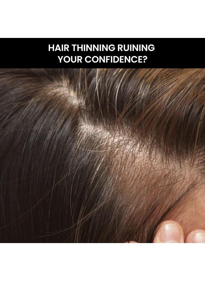 THRIVECO - Hair Thickener Volumizing Serum | For Fine, Thinning Hair | Gives Instant Hair Volume & Density | With Pea Peptide & Rosemary | For Men & Women | Vegan, Cruelty-Free & Dermat-Tested | 100Ml - Image 1