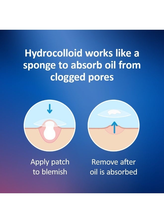 Nexcare Acne Patch, Blemish Cover - Image 3