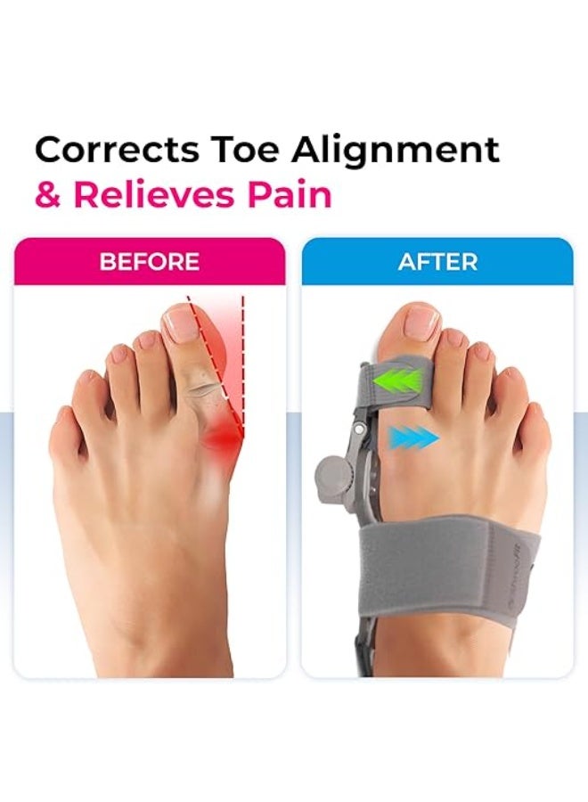 Adjustable Bunion Corrector (2-Pack) & Hammer Toe Corrector – Orthopedic Splint for Hallux Valgus & Pain Relief – Day & Night Use for Men & Women - Image 4