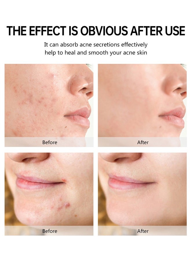 MYMI Miracle Patch, Invisible Spot Cover, Ideal for On The Surface Spots,Salicylic Acid Hydrocolloid Acne Patch  - Image 5