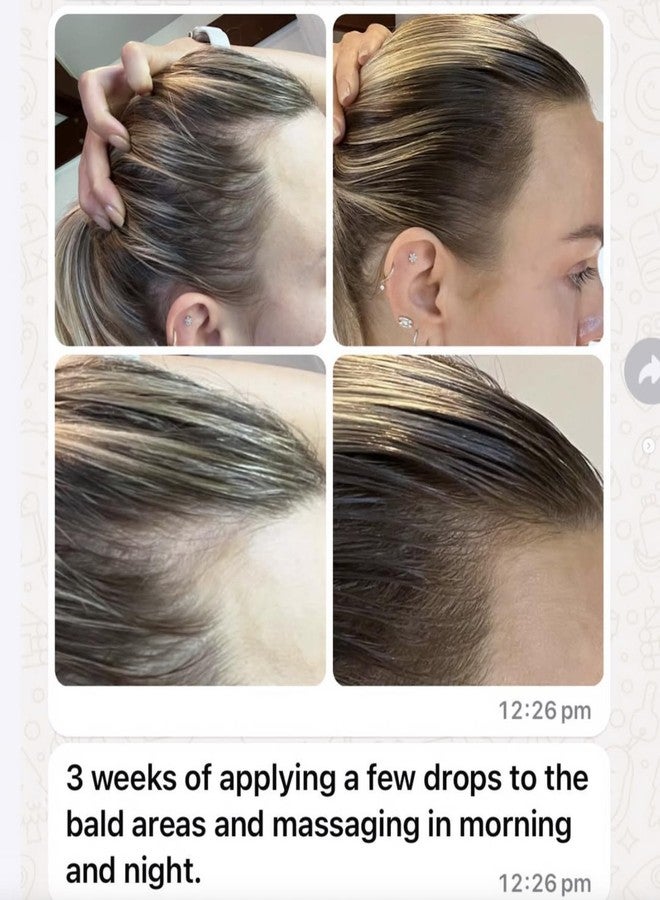 JSHealth سيروم فروة الرأس فيتا-غروث من جيه إس هيلث للفيتامينات لكثافة الشعر وحيوية فروة الرأس - سيروم شعر للنساء مع الببتيدات والفيتامينات والأحماض الأمينية - Image 4