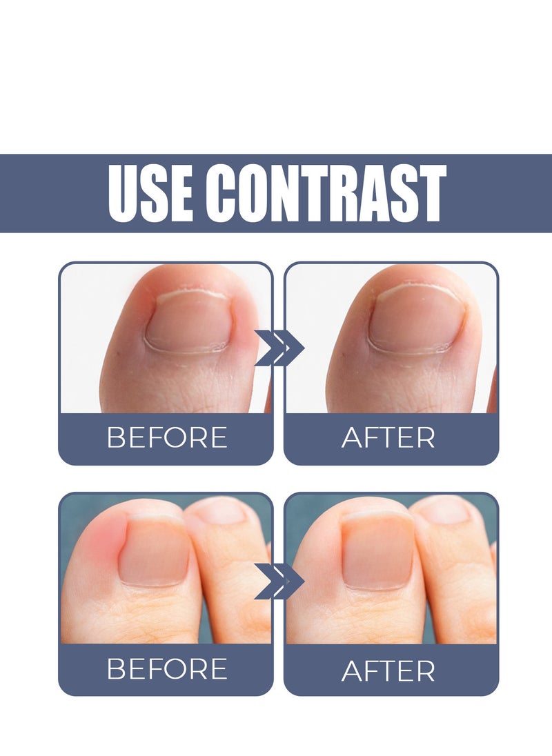 Toenail Care Removal Paronychia Oil, Toenail Care's Best Toenail Repair Solution, Toenail Care's Anti Toenail Parasite Relief Oil