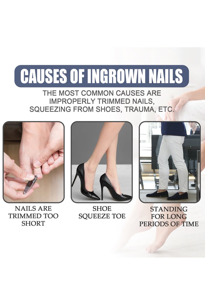Toenail Care Removal Paronychia Oil, Toenail Care's Best Toenail Repair Solution, Toenail Care's Anti Toenail Parasite Relief Oil