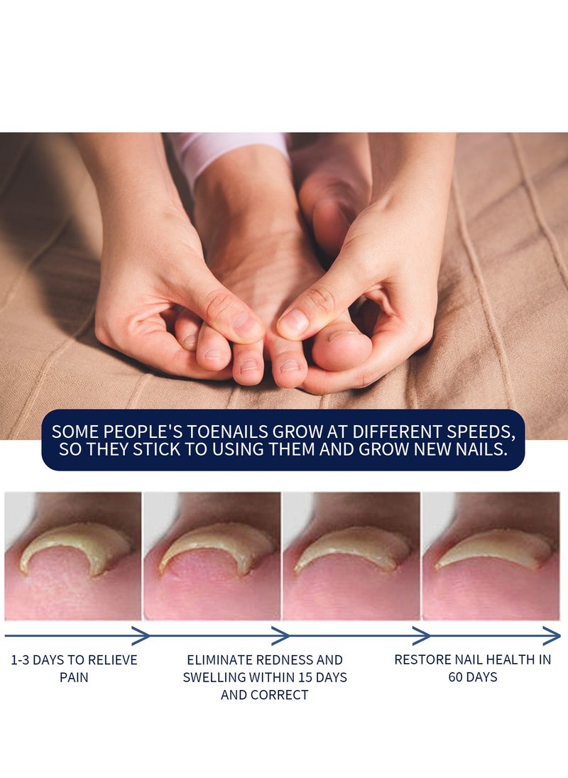 Toenail Care Removal Paronychia Oil, Toenail Care's Best Toenail Repair Solution, Toenail Care's Anti Toenail Parasite Relief Oil