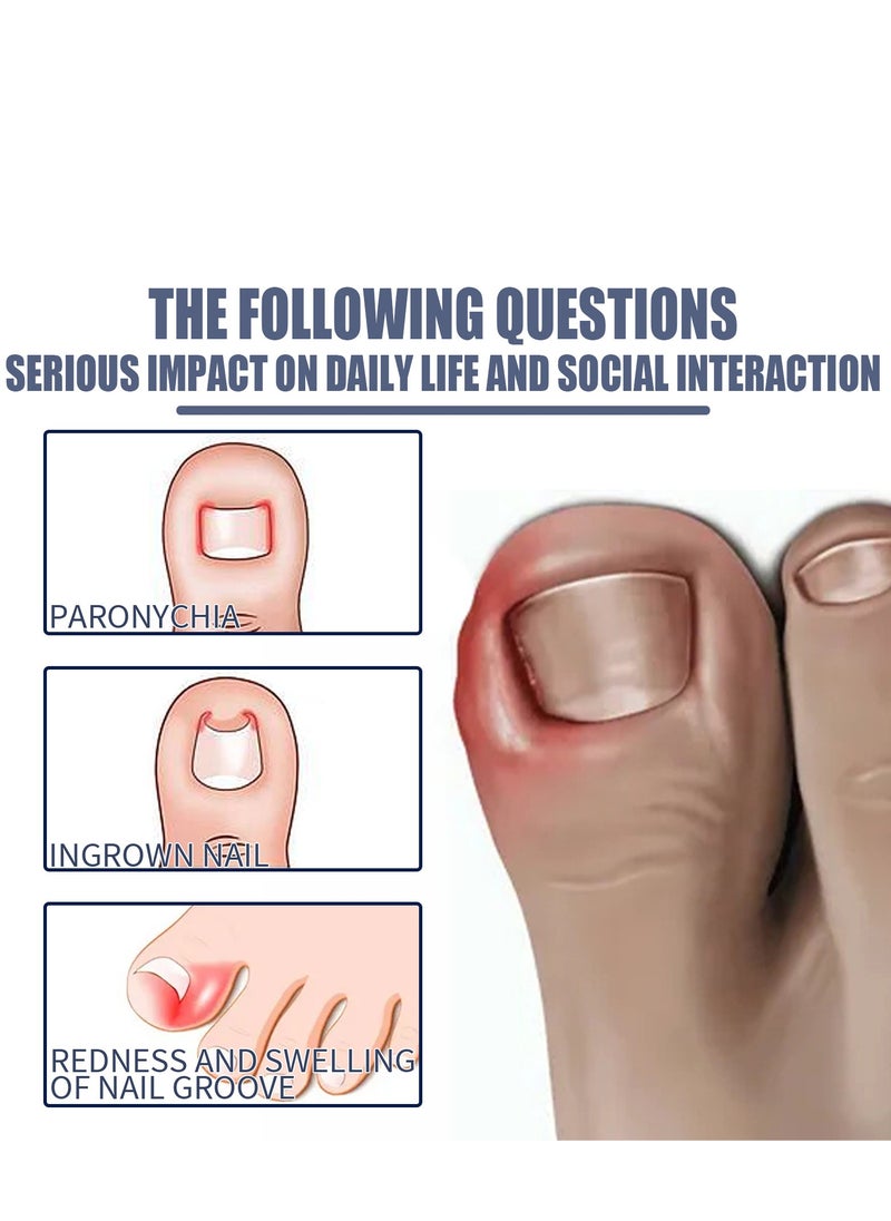Toenail Care Removal Paronychia Oil, Toenail Care's Best Toenail Repair Solution, Toenail Care's Anti Toenail Parasite Relief Oil