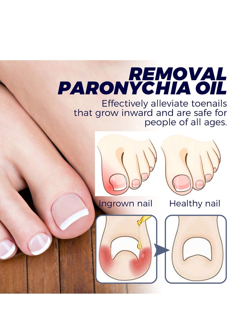 Toenail Care Removal Paronychia Oil, Toenail Care's Best Toenail Repair Solution, Toenail Care's Anti Toenail Parasite Relief Oil