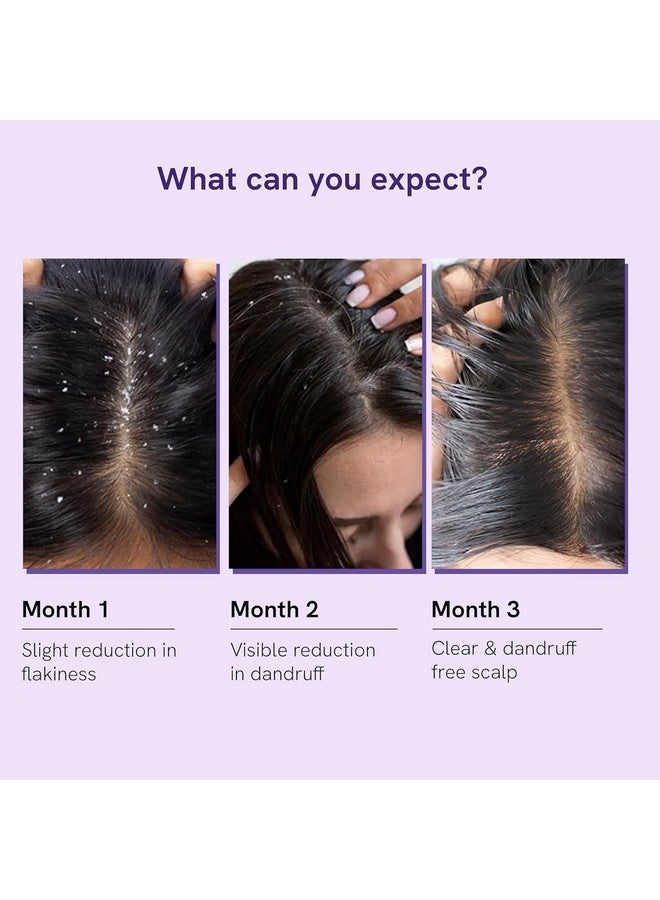 Be Bodywise Anti Dandruff Shampoo For Women 300Ml | Targets Dandruff, & Removes Visible Flakes | Reduces Inflammation | Shampoo For Smooth & Frizz Free Hair | Pack Of 2 - Image 5