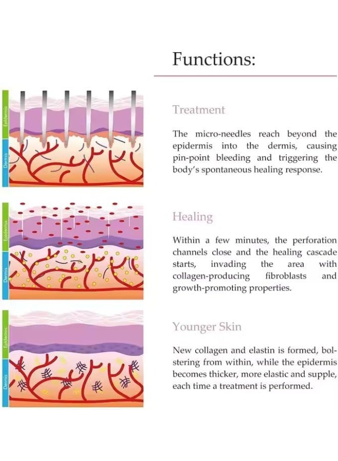 Derma Roller 540-Piece Needles For The Treatment Of Wrinkles, Hair Loss And Baldness Black/Pink - Image 4