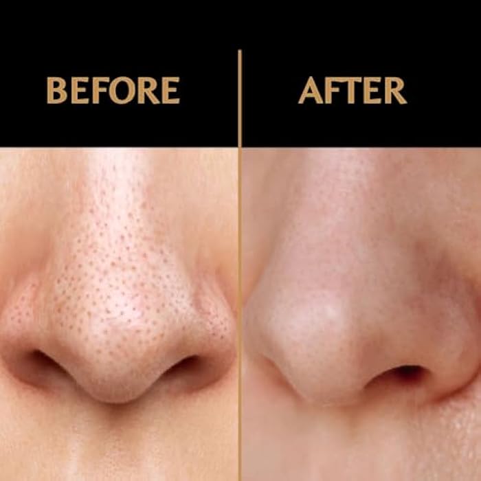 MS Premium Exfoliating Facial Mitt - Dry Skin Remover for Face, Deep Exfoliating Scrubber, Instantly Removes Dry Skin, Gently Improves Complexion, Shower Mitt for Gentle Face Exfoliation, 1pc - Black - Image 3