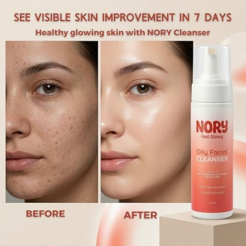 NORY Oily Facial Cleanser with Salicylic Acid, Niacinamide, Green Tea and Hyaluronic Acid, 200ml - Image 5