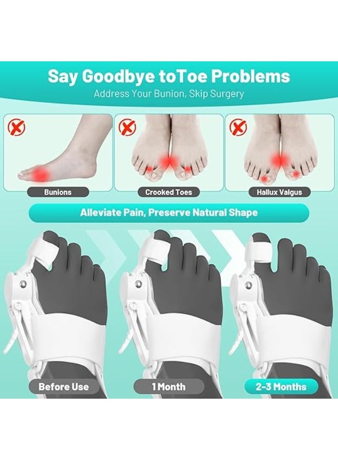 Upgraded Bunion Corrector with Press-Button Adjustment – Big Toe Separator & Silicone Pad, Orthopedic Bunion Splint for Left & Right Foot – For Men & Women - Image 5