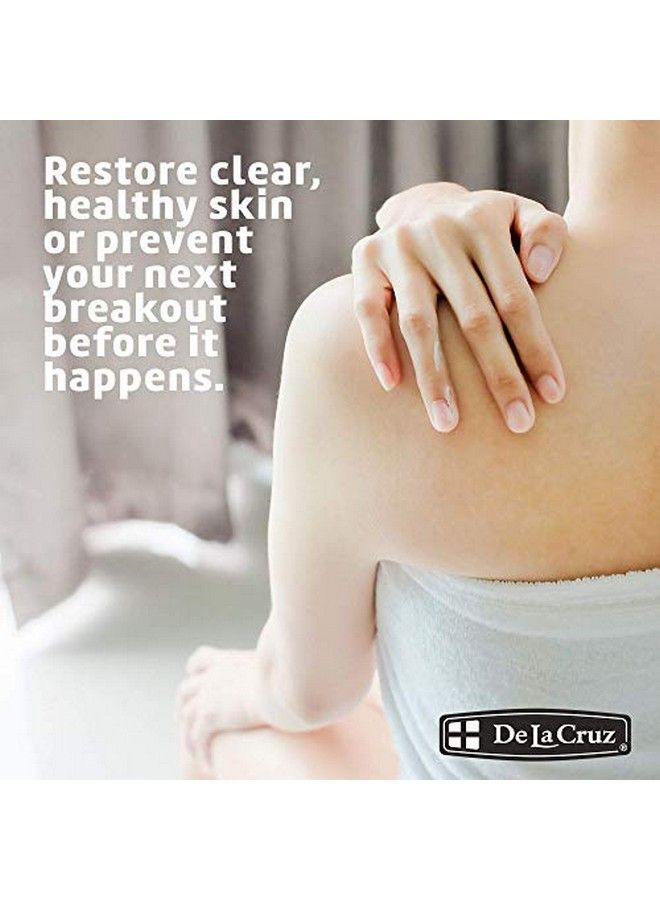De La Cruz مرهم الكبريت 10% لعلاج حب الشباب القضاء على حبوب كيسية والرؤوس السوداء على الوجه والجسم صنع في الولايات المتحدة بحجم جامبو 5.5 أونصة - Image 5