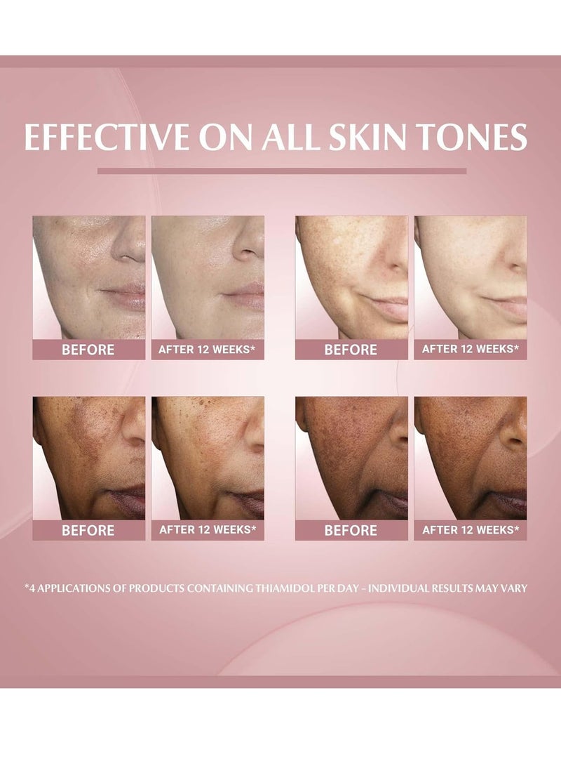 مصل الوجه ايفن بيجمنت بيرفيكتور سكين بيرفيكتينج مع الثياميدول وحمض الهيالورونيك 30  مل - Image 3