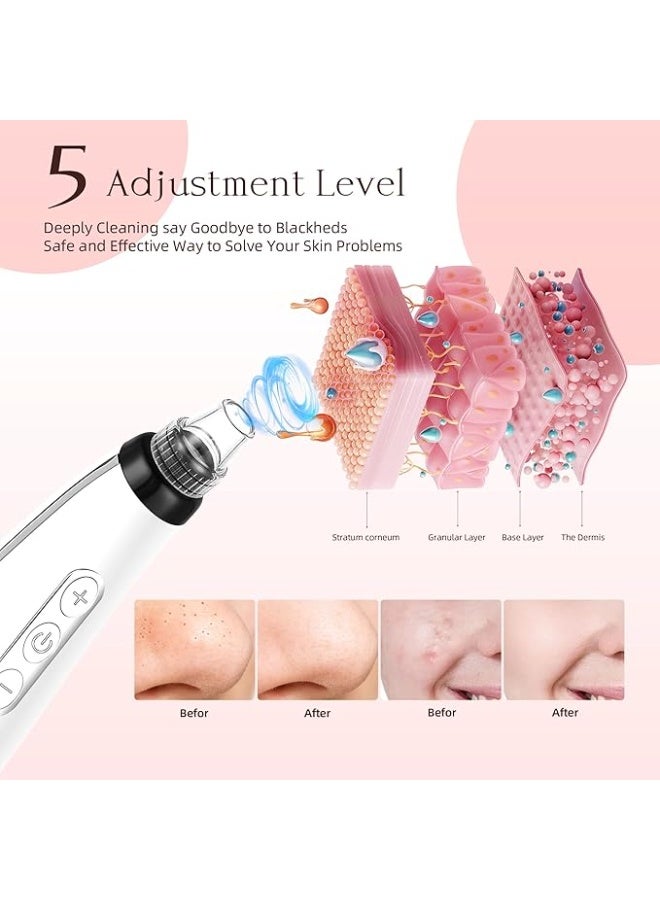 LENND Blackhead Remover Pore Vacuum, Blackhead Extractor Tool Facial Pore Cleaner Electric Comedone Whitehead Extractor Tool-5 Suction Power,5 Probes,USB Rechargeable Blackhead Vacuum Kit - Image 2