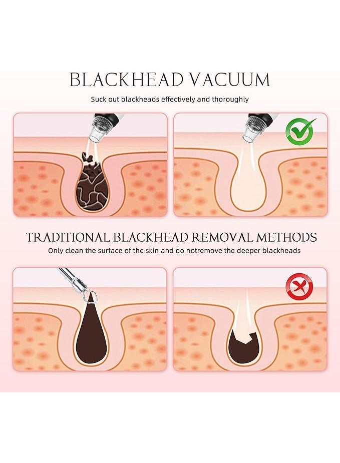 LENND Blackhead Remover Pore Vacuum, Blackhead Extractor Tool Facial Pore Cleaner Electric Comedone Whitehead Extractor Tool-5 Suction Power,5 Probes,USB Rechargeable Blackhead Vacuum Kit - Image 3