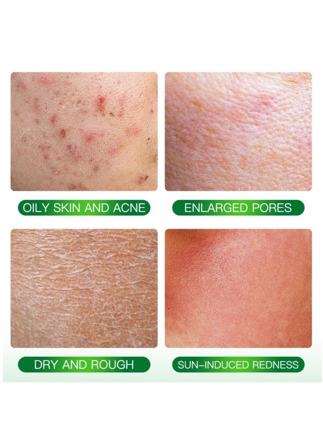 Kormesic Organic Aloe Vera Gel 200ML Moisturizing Repairing Soothing Sunburn Improve Acne Scars Aloe Vera Gel for Face And Body Hydrating Nourishing Healing Skincare Aloevera Gel - Image 4