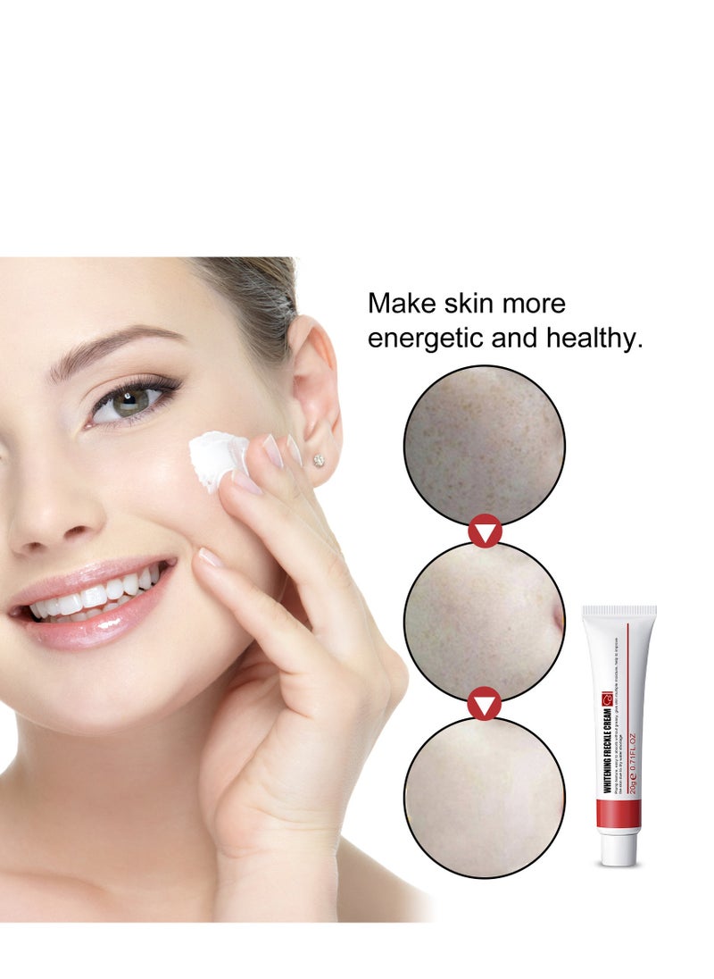 EELHOE - Whitening Freckle Cream Help Reduce Dark Spots | Anti-Aging |Beauty Skin Care | Spot Cream | Spot treatment  20g - Image 1
