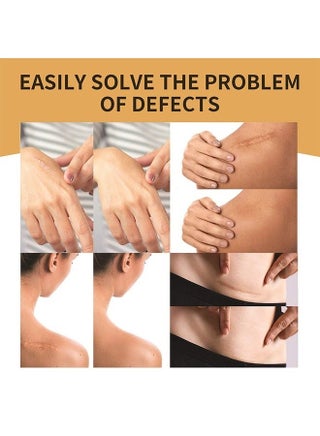 6 Patch Tattoo Cover Up Tape, Ultra Thin Skin Tone Concealer Sticker, Invisible Concealer Patch for Covering up Tattoos and Scars - view 3