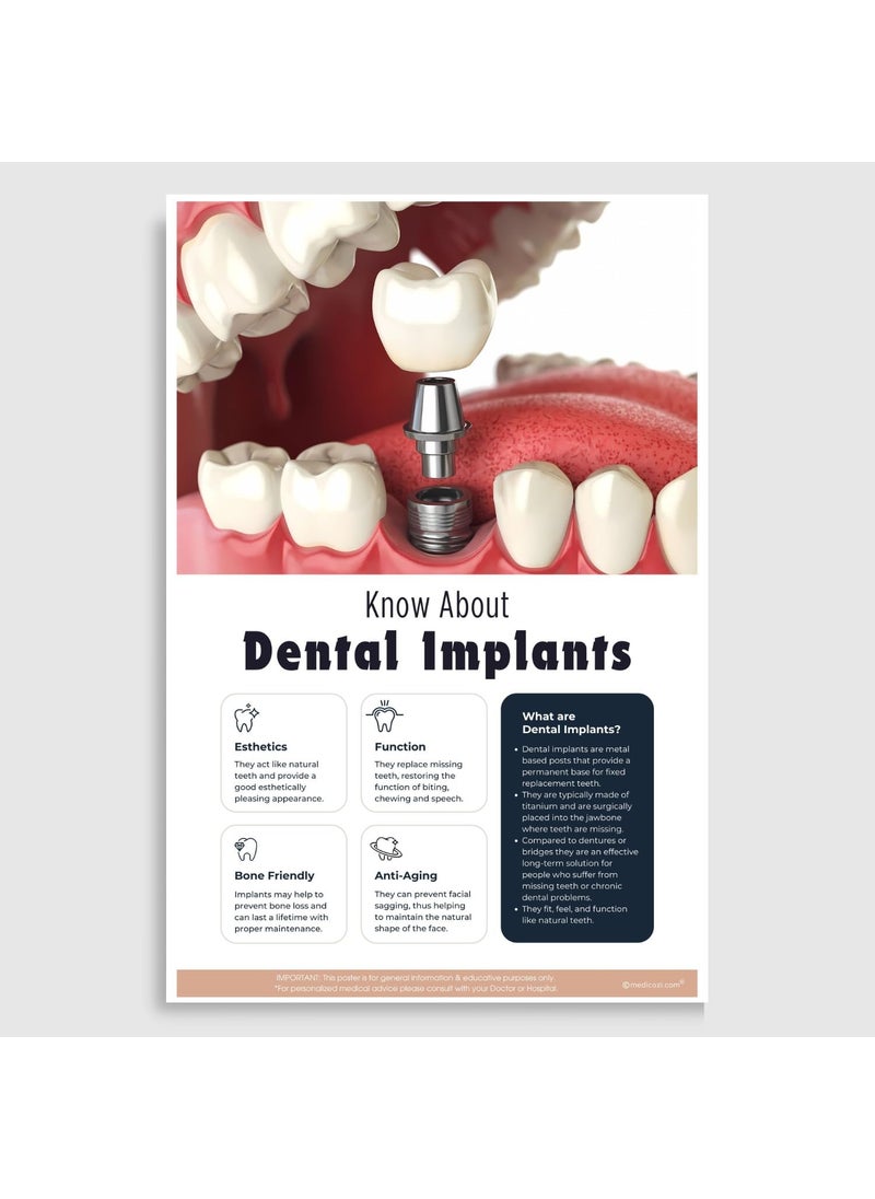 Medicozi Medicozi Dental Implants and Clear Aligner Orthodontic Braces poster for Clinics Set of 2 Unframed 12x18 inches Prosthodontist Dentist waiting room Art Patient Education  - Image 2