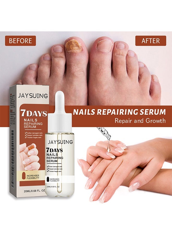 Jaysuing 7 Days Nails Repairing Serum, Nail Nutrient Oil Strengthener Oil Serum Nail Growth Oil, Nail Cuticle Oil Strengthener, Nail Serum For Growth And Repair For Damaged Nails, 20ML - Image 2