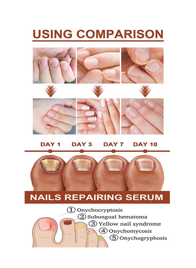 Jaysuing 7 Days Nails Repairing Serum, Nail Nutrient Oil Strengthener Oil Serum Nail Growth Oil, Nail Cuticle Oil Strengthener, Nail Serum For Growth And Repair For Damaged Nails, 20ML - Image 4