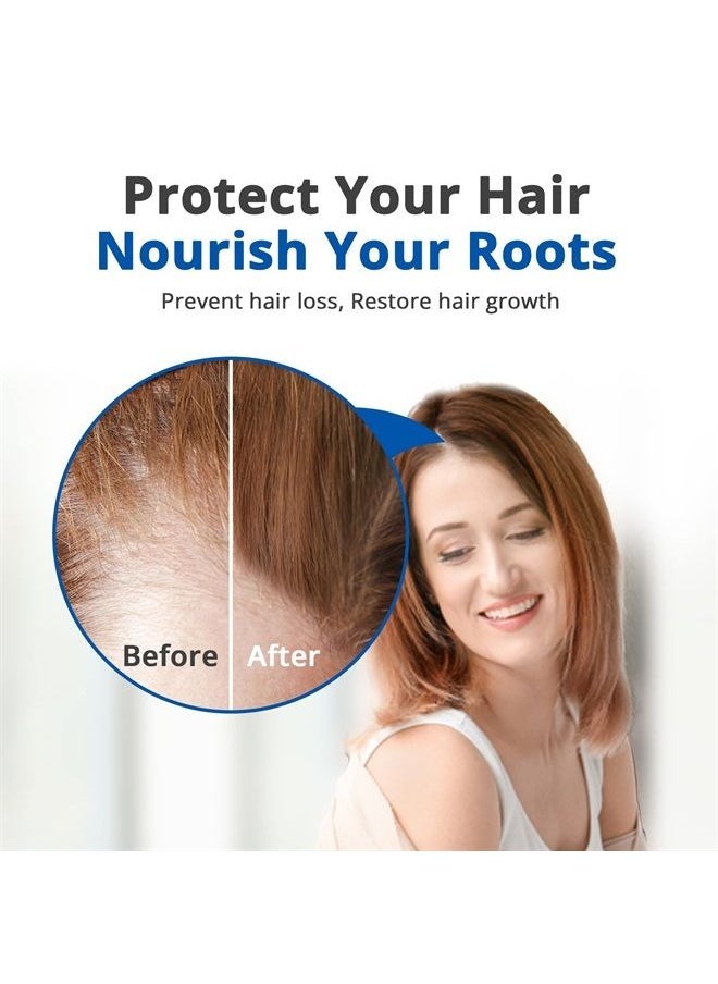 HAIRMETTO - ® Topical Hair Serum for Hair Regrowth, Hair Loss Products with Extracted Saw Palmetto Oil for Bald Spots, Soothes Dry and Itchy Scalp, Non-Oily, Peppermint Scent, 118 mL Bottle - Image 1