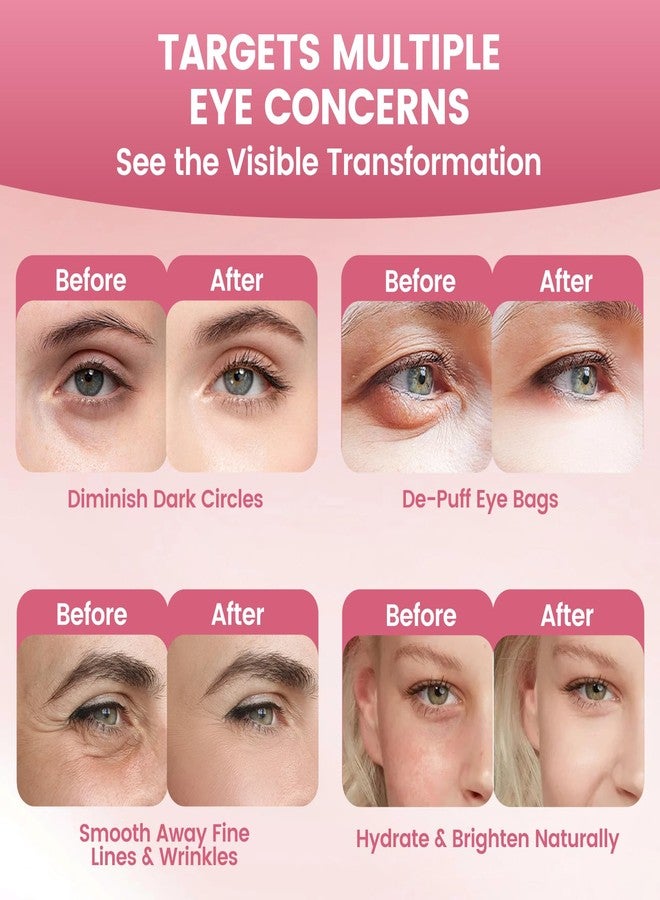 Pwkvsn Deep Peptide Collagen Eye Mask 12 Pairs, Full Eye Mask Patches with Bio-Collagen Peptide, Deep Hydrating Overnight Under Eye Patches for Dark Circles Puffy Eyes Wrinkles (2) - Image 3