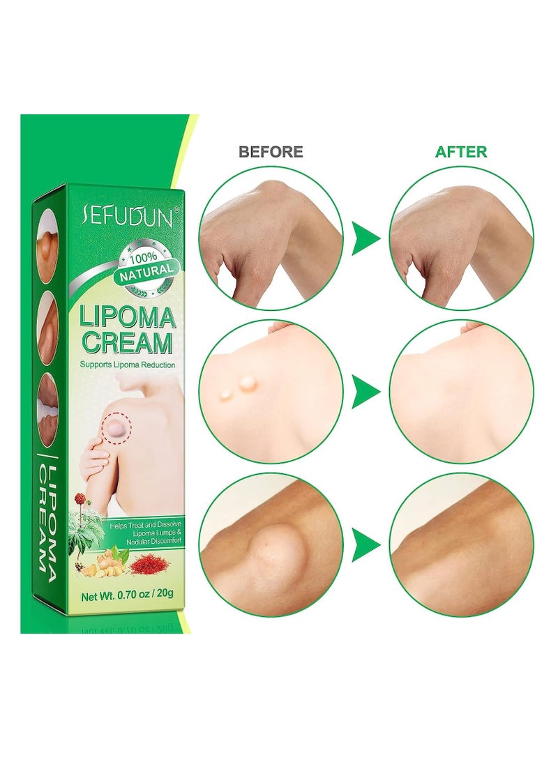 Sefudun - Lipoma Cream Lump Free Lipoma Removal Cream Herbal Lipoma Lumps Removal & Nodular Discomfort Ointment Reduce Fatty Lumps Easy to Absorb Safe & Effective Lipoma Treatment 20g - Image 1