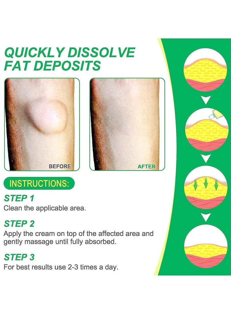 Sefudun - Lipoma Cream Lump Free Lipoma Removal Cream Herbal Lipoma Lumps Removal & Nodular Discomfort Ointment Reduce Fatty Lumps Easy to Absorb Safe & Effective Lipoma Treatment 20g - Image 1