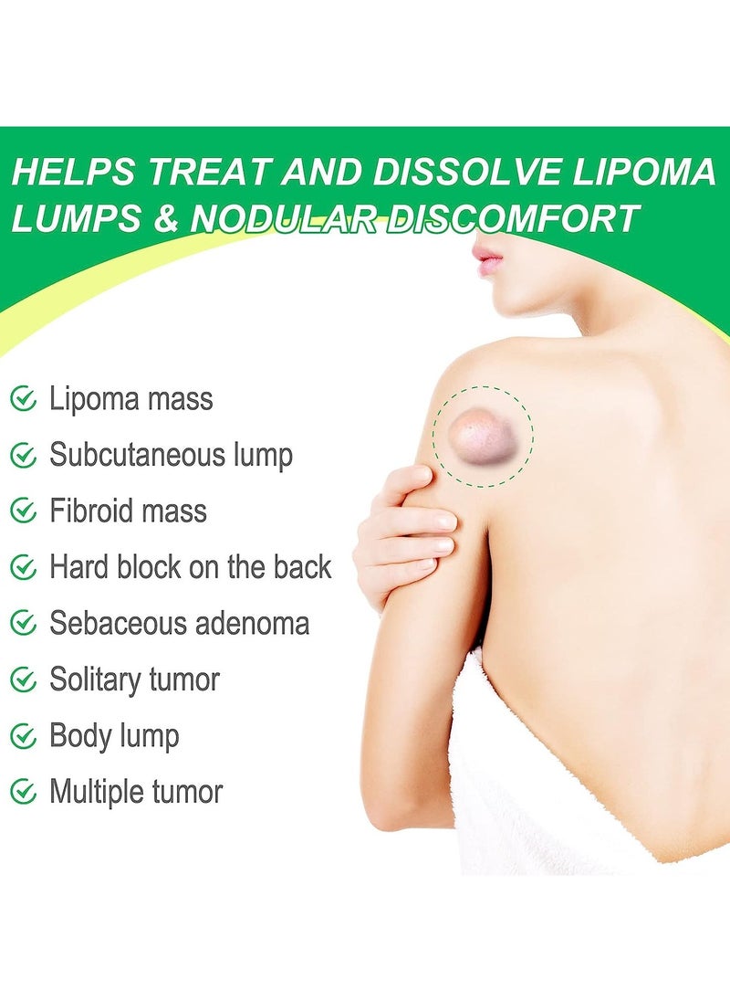 Sefudun - Lipoma Cream Lump Free Lipoma Removal Cream Herbal Lipoma Lumps Removal & Nodular Discomfort Ointment Reduce Fatty Lumps Easy to Absorb Safe & Effective Lipoma Treatment 20g - Image 1