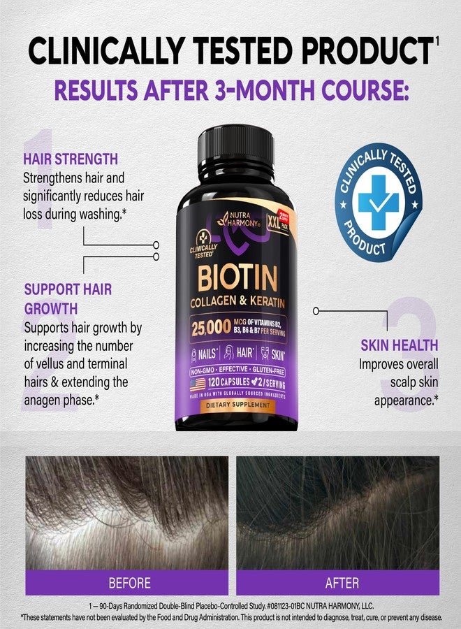 NUTRAHARMONY Biotin | Collagen | Hyaluronic Acid | Keratin - Support Normal Hair Growth Cycle, Skin & Nails - Clinically Tested - 25000mcg Vitamins B1, B2, B3, B6 & B7 - for Women & Men - Made in USA, 120 Capsules - Image 4