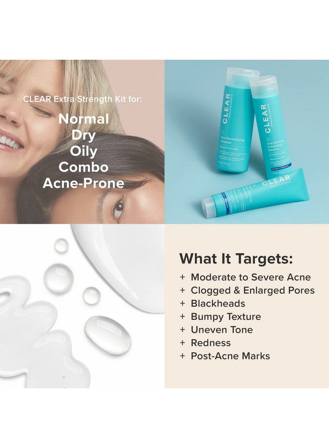 باولاز تشويس مجموعة Paula's Choice CLEAR Extra Strength لعلاج حب الشباب، 2% حمض الساليسيليك و5% بيروكسيد البنزويل لعلاج حب الشباب الشديد وتخفيف الاحمرار، قد تختلف العبوة - Image 5