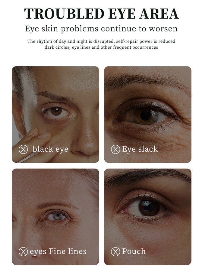 OCHEAL Retin A Ester Elastic Moisturizing Eye Cream - Daily Eye Wrinkle Cream Eye Cream With Vitamin and Retinol Complex Brightening Anti Aging Line Smoothing Skin Care - Image 4