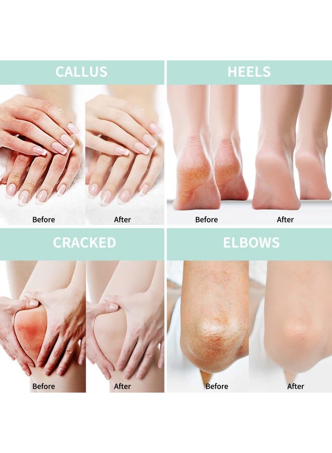 Grocerism Urea Cream 20 Percent Plus 2% Salicylic Acid 5.29 oz with Moisturizing Socks || Callus Remover Foot Cream, Hand Cream for Dry ed Heels, Feet, Hands, Knees, Elbows, and Deep Moisturizes, Soften Callus - Image 4