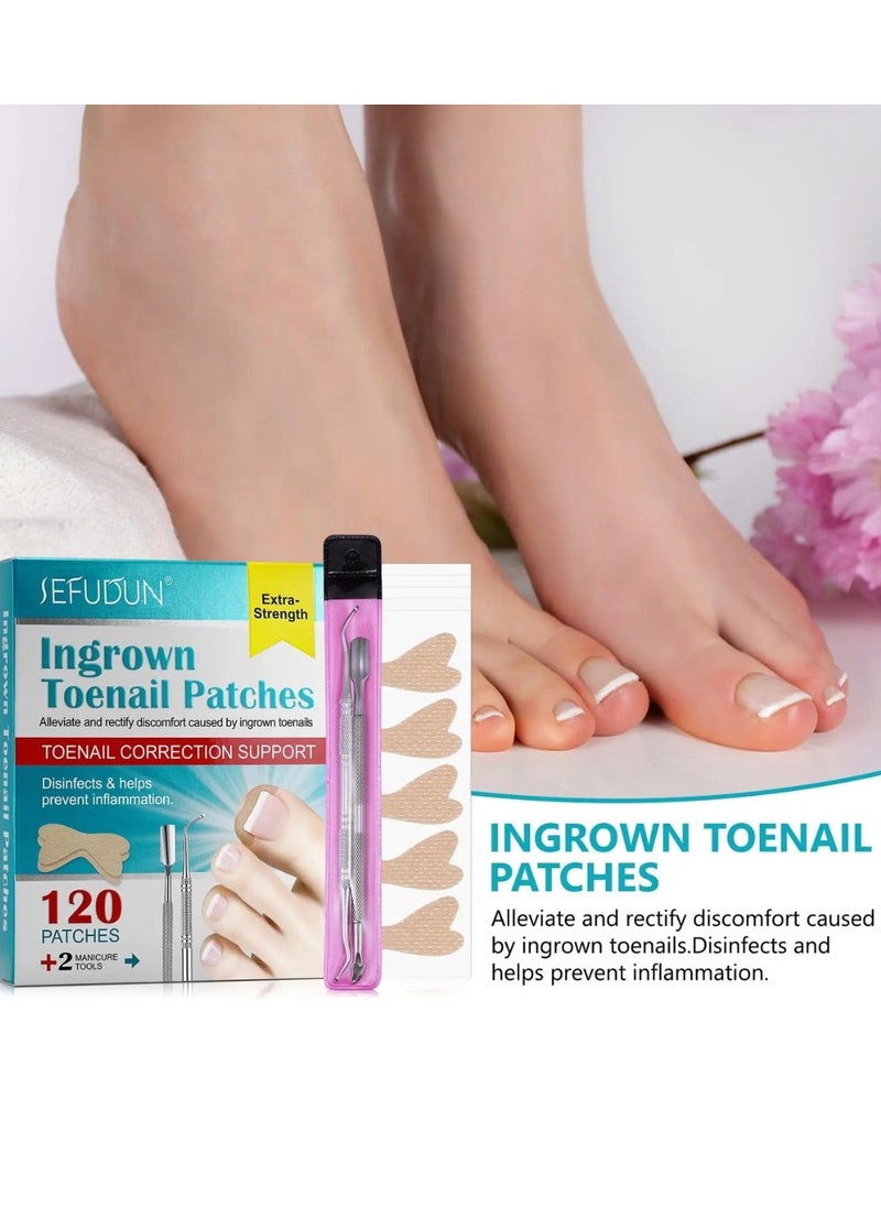 120 pcs Ingrown Toenail Corrector Patches with 2 Manicure Tools Ingrown Toenail Correction Stickers for Toenail Repair Glue Free Ingrown Toenail Corrector Strips Toenail File Patches