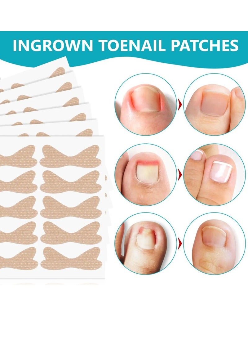 120 pcs Ingrown Toenail Corrector Patches with 2 Manicure Tools Ingrown Toenail Correction Stickers for Toenail Repair Glue Free Ingrown Toenail Corrector Strips Toenail File Patches