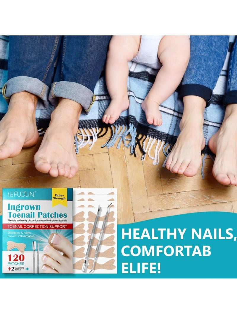 120 pcs Ingrown Toenail Corrector Patches with 2 Manicure Tools Ingrown Toenail Correction Stickers for Toenail Repair Glue Free Ingrown Toenail Corrector Strips Toenail File Patches