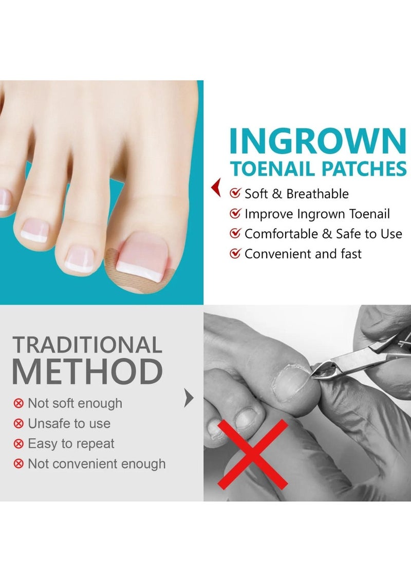 120 pcs Ingrown Toenail Corrector Patches with 2 Manicure Tools Ingrown Toenail Correction Stickers for Toenail Repair Glue Free Ingrown Toenail Corrector Strips Toenail File Patches